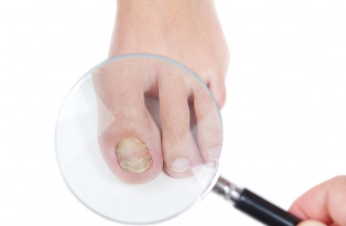 Anerer sprooch liesen